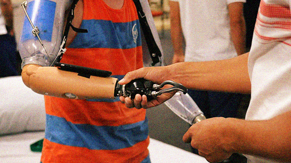 Two people, one who has a prosthetic arm, shaking hands